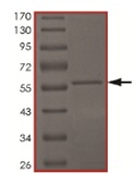 Recombinant Human CDKL4 protein