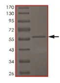 SDS-PAGE - Recombinant Human CDKL4 protein (AB167967)