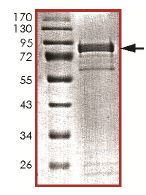 SDS-PAGE - Recombinant Human CDKL5 protein (AB131695)