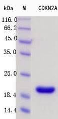 SDS-PAGE - Recombinant Human CDKN2A/p16INK4a Protein Standard (His tag) (AB316386), expandable thumbnail