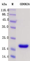 SDS-PAGE - Recombinant Human CDKN2A/p16INK4a Protein Standard (His tag) (AB316386)