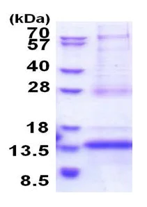 SDS-PAGE - Recombinant Human CDKN2AIPNL protein (His tag N-Terminus) (AB177647)