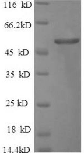 SDS-PAGE - Recombinant Human CDR2 protein (His tag) (AB235677)