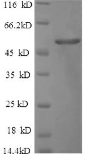 SDS-PAGE - Recombinant Human CDR2 protein (His tag) (AB235677)