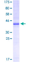 Recombinant Human CDS1 protein