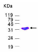 SDS-PAGE - Recombinant Human CDT2/RAMP protein (AB80154), expandable thumbnail