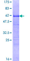 Recombinant Human CDX2 protein