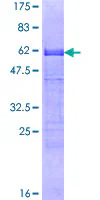 SDS-PAGE - Recombinant Human CDX2 protein (GST tag N-Terminus) (AB114247)