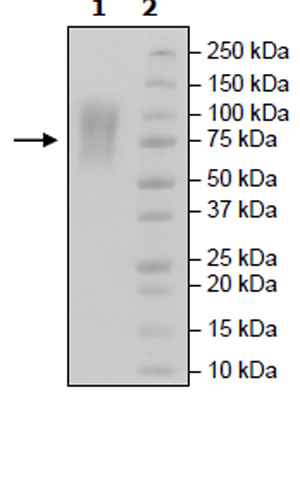 Recombinant Human CEACAM1 protein (Tagged) (Biotin)
