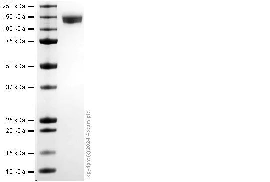 SDS-PAGE - Recombinant Human CEACAM5/CEA Protein (His-tag) (AB317870)