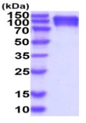 SDS-PAGE - Recombinant Human CEACAM5 protein (His tag) (AB222987)