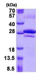SDS-PAGE - Recombinant Human CEACAM7 protein (His tag N-Terminus) (AB156717)