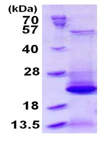 SDS-PAGE - Recombinant Human CEAP protein (His tag N-Terminus) (AB126912)