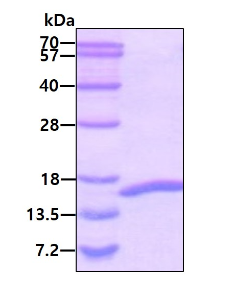 SDS-PAGE - Recombinant Human CEBP Alpha/CEBPA protein (His tag N-Terminus) (AB51301)