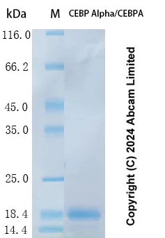 SDS-PAGE - Recombinant Human CEBP Alpha/CEBPA Protein Standard (His tag) (AB323158)
