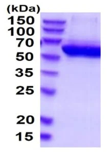 SDS-PAGE - Recombinant Human CECR1 protein (His tag) (AB219217)