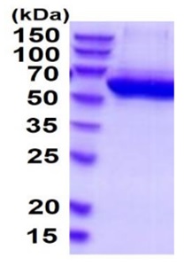 SDS-PAGE - Recombinant Human CECR1 protein (His tag C-Terminus) (AB219217)