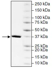 SDS-PAGE - Recombinant Human CECR2 protein (AB196137)