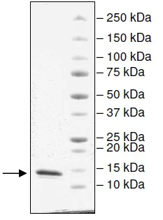 SDS-PAGE - Recombinant human CECR2 protein (Active) (AB196136)