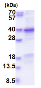 SDS-PAGE - Recombinant Human CEE protein (His tag) (denatured) (AB177608), expandable thumbnail