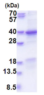 SDS-PAGE - Recombinant Human CEE protein (His tag) (denatured) (AB177608)