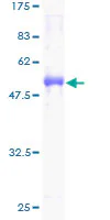 SDS-PAGE - Recombinant Human Cela3b protein (GST tag N-Terminus) (AB161644)