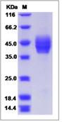 SDS-PAGE - Recombinant Human Cell adhesion molecule 2 protein (His tag) (AB276681)