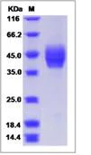 SDS-PAGE - Recombinant Human Cell adhesion molecule 2 protein (His tag) (AB276681)