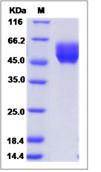 SDS-PAGE - Recombinant Human Cell adhesion molecule 4 protein (His tag) (AB276702)