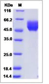 SDS-PAGE - Recombinant Human Cell adhesion molecule 4 protein (His tag) (AB276702)