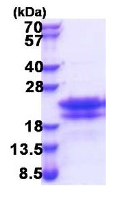 SDS-PAGE - Recombinant Human CEND1 protein (His tag N-Terminus) (AB174454)