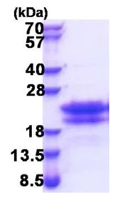 SDS-PAGE - Recombinant Human CEND1 protein (His tag N-Terminus) (AB174454)