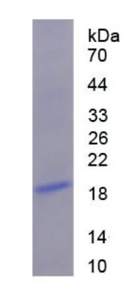 SDS-PAGE - Recombinant Human CENPB protein (His tag) (AB275796)