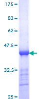 SDS-PAGE - Recombinant Human CENPE protein (AB158097), expandable thumbnail
