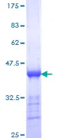 SDS-PAGE - Recombinant Human CENPE protein (GST tag N-Terminus) (AB158097)