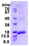 SDS-PAGE - Recombinant Human CENPH protein (denatured) (AB113134)