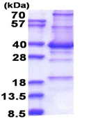 SDS-PAGE - Recombinant Human CENPP protein (denatured) (His tag N-Terminus) (AB174396)