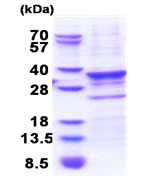 SDS-PAGE - Recombinant Human CENPQ protein (denatured) (AB174427)