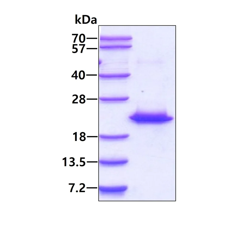 SDS-PAGE - Recombinant Human Centrin 2 protein (AB116203)