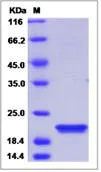 SDS-PAGE - Recombinant Human Centrin 2 protein (His tag) (AB276631)