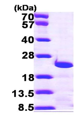SDS-PAGE - Recombinant Human Centrin 3 protein (AB100940)
