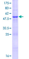 Recombinant Human CEP27 protein
