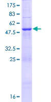 SDS-PAGE - Recombinant Human CEP27 protein (AB162978)
