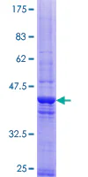 SDS-PAGE - Recombinant Human CEP290 protein (GST tag N-Terminus) (AB164215)