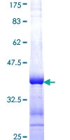 Recombinant Human Ceramide glucosyltransferase protein