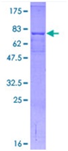 SDS-PAGE - Recombinant Human CETP protein (AB114408)
