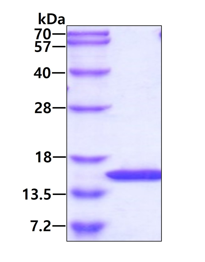 SDS-PAGE - Recombinant Human CFA protein (Tag Free) (AB86691)