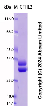 SDS-PAGE - Recombinant Human CFHL2 Protein Standard (His tag) (AB323031)