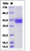 SDS-PAGE - Recombinant Human CFHR1 protein (His tag) (AB276493)
