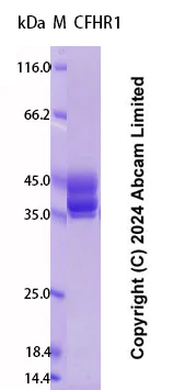 SDS-PAGE - Recombinant Human CFHR1 Protein Standard (AB323028)